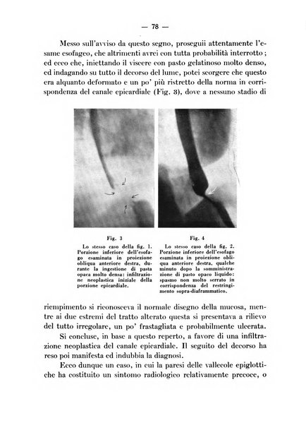 Archivio italiano per le malattie della trachea, bronchi, esofago