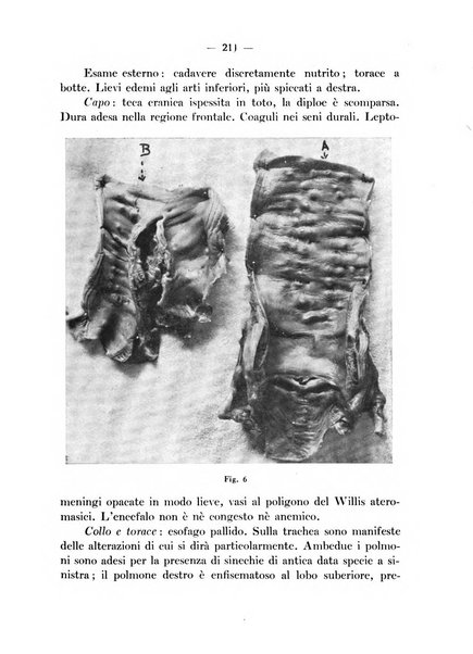 Archivio italiano per le malattie della trachea, bronchi, esofago