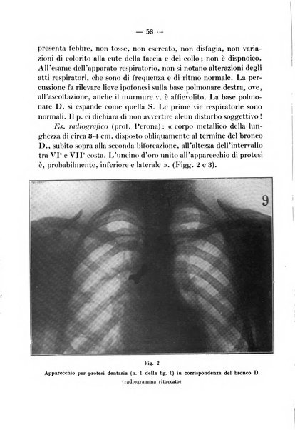 Archivio italiano per le malattie della trachea, bronchi, esofago