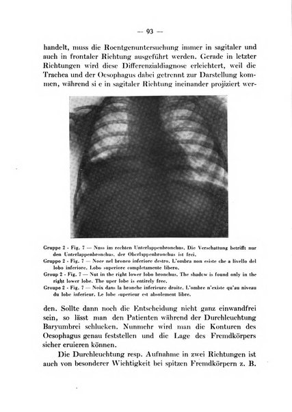 Archivio italiano per le malattie della trachea, bronchi, esofago