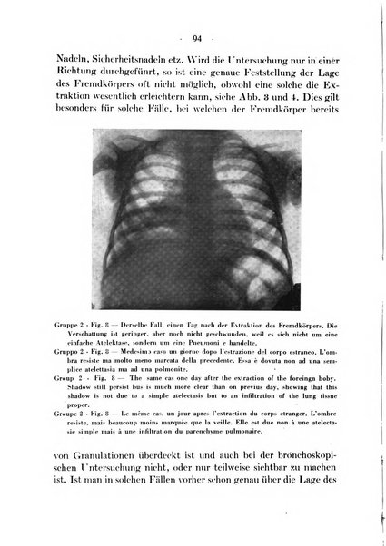 Archivio italiano per le malattie della trachea, bronchi, esofago