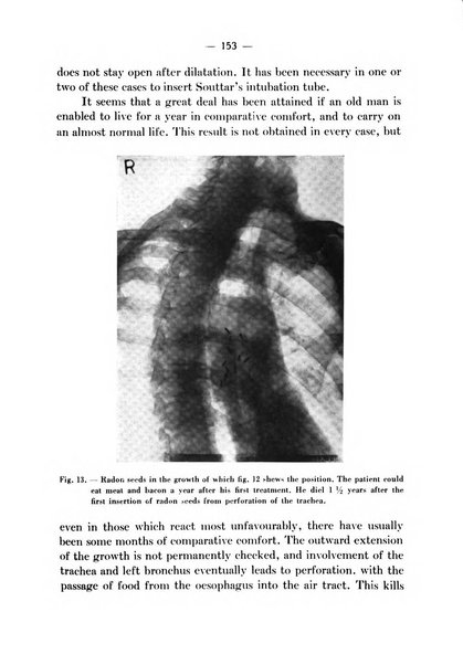 Archivio italiano per le malattie della trachea, bronchi, esofago