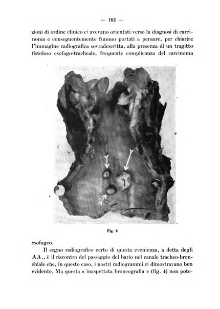 Archivio italiano per le malattie della trachea, bronchi, esofago