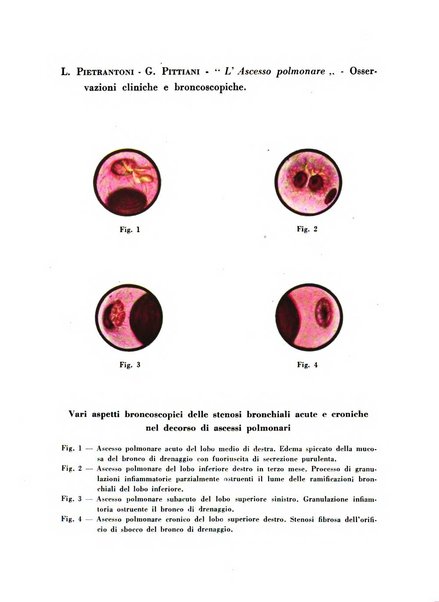 Archivio italiano per le malattie della trachea, bronchi, esofago