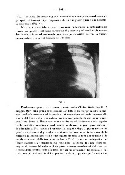 Archivio italiano per le malattie della trachea, bronchi, esofago