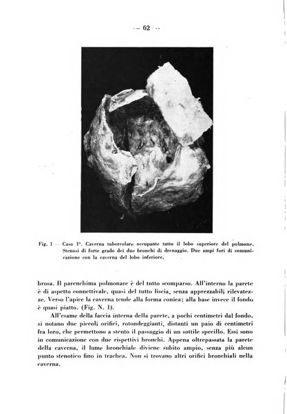 Archivio italiano per le malattie della trachea, bronchi, esofago