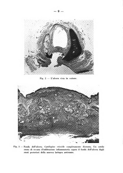 Archivio italiano per le malattie della trachea, bronchi, esofago