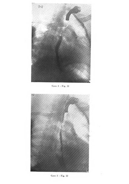 Archivio italiano per le malattie della trachea, bronchi, esofago