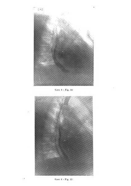 Archivio italiano per le malattie della trachea, bronchi, esofago