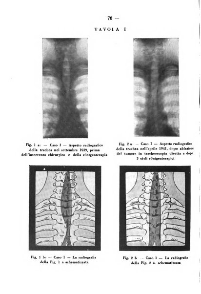 Archivio italiano per le malattie della trachea, bronchi, esofago