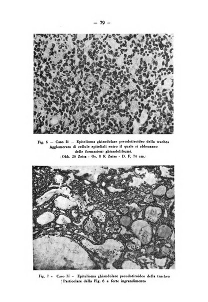 Archivio italiano per le malattie della trachea, bronchi, esofago