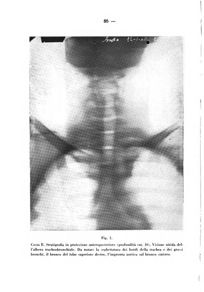 Archivio italiano per le malattie della trachea, bronchi, esofago