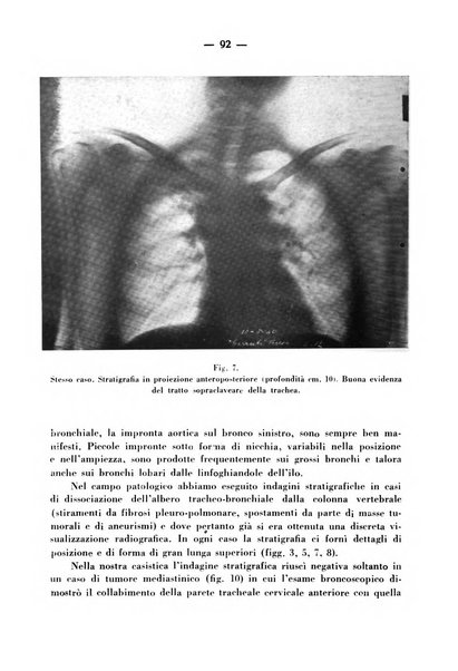 Archivio italiano per le malattie della trachea, bronchi, esofago