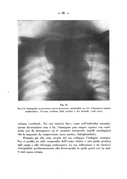 Archivio italiano per le malattie della trachea, bronchi, esofago