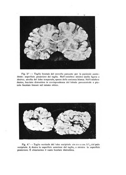 Il cervello Giornale di nevrologia