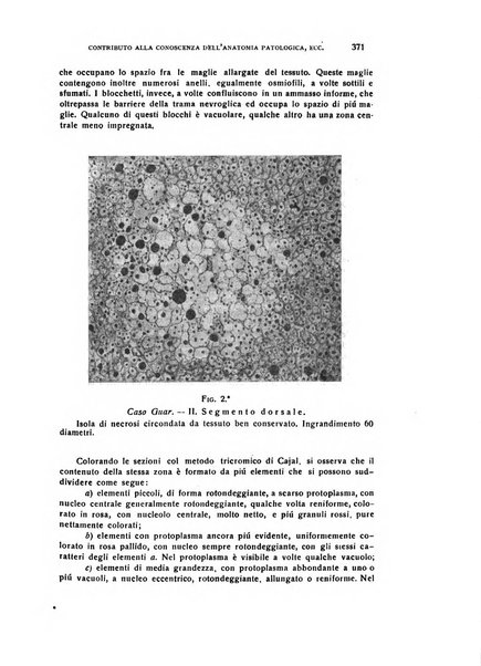 Il cervello Giornale di nevrologia