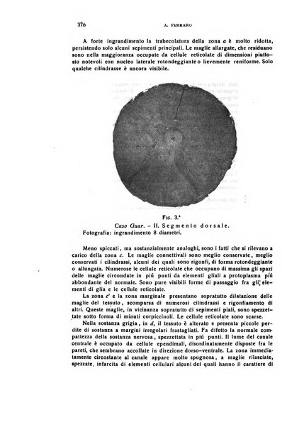 Il cervello Giornale di nevrologia