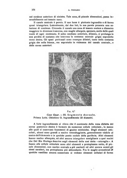 Il cervello Giornale di nevrologia