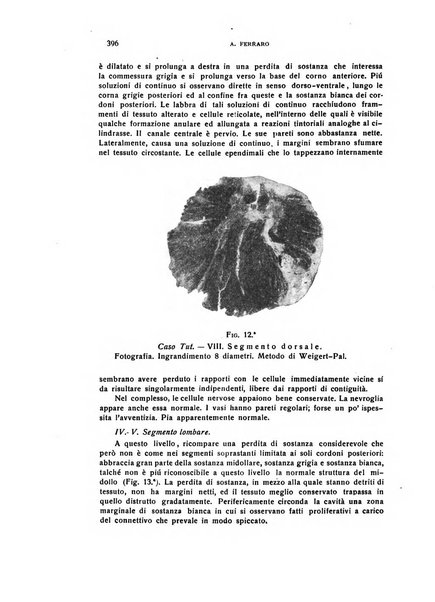 Il cervello Giornale di nevrologia