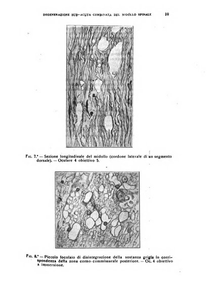 Il cervello Giornale di nevrologia