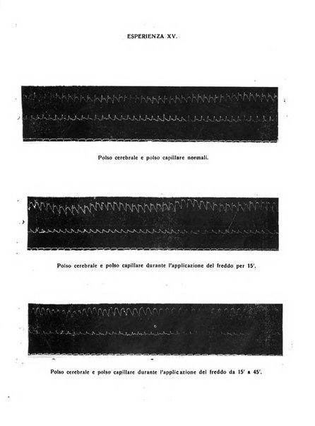 Il cervello Giornale di nevrologia