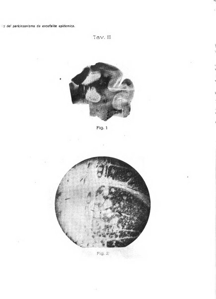 Il cervello Giornale di nevrologia