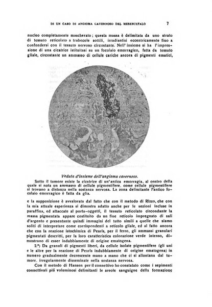 Il cervello Giornale di nevrologia