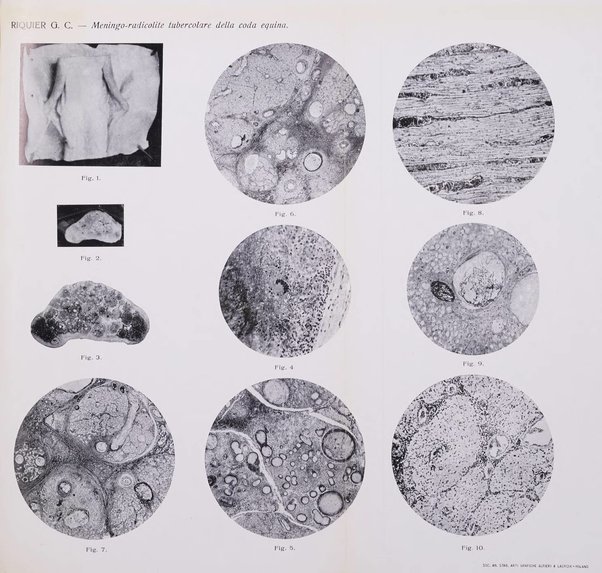 Il cervello Giornale di nevrologia