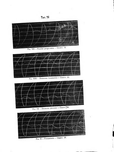 Il cervello Giornale di nevrologia