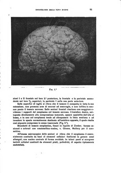 Il cervello Giornale di nevrologia