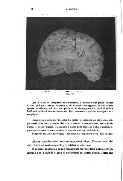 Il cervello Giornale di nevrologia