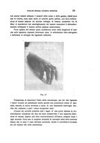 giornale/CFI0349856/1933/unico/00000185