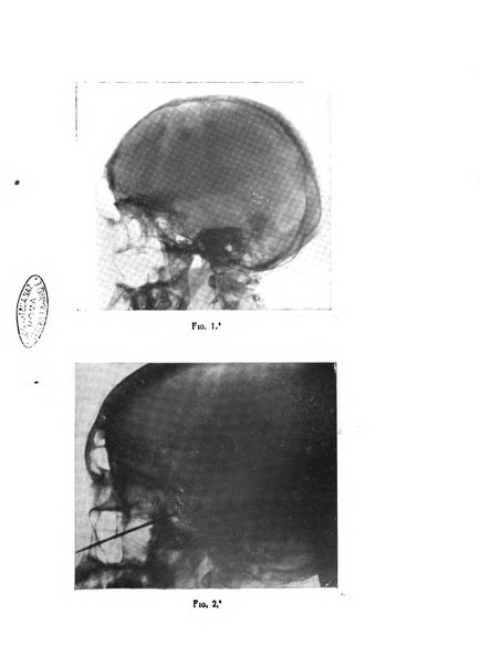 Il cervello Giornale di nevrologia