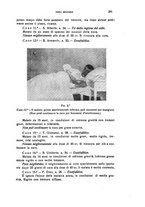 giornale/CFI0349856/1935/unico/00000325