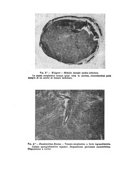 Il cervello Giornale di nevrologia