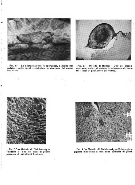 Il cervello Giornale di nevrologia