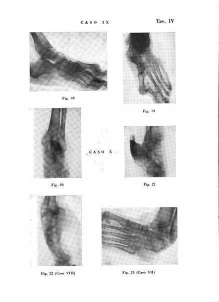 Il cervello Giornale di nevrologia