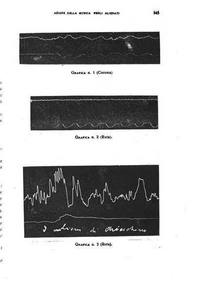 Il cervello Giornale di nevrologia