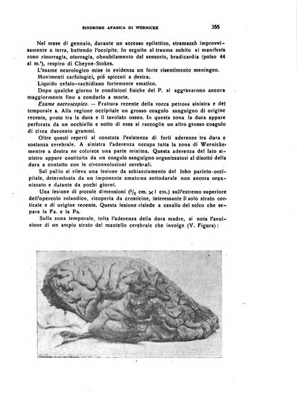 Il cervello Giornale di nevrologia