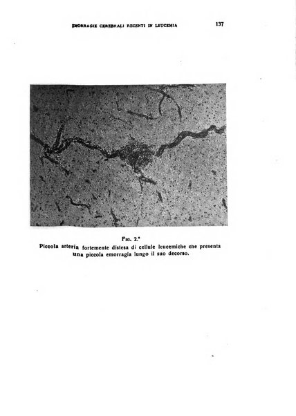 Il cervello Giornale di nevrologia