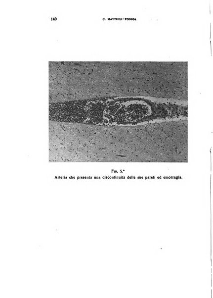 Il cervello Giornale di nevrologia