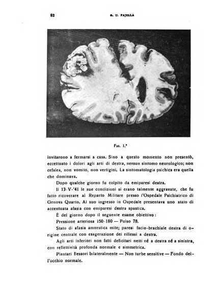 Il cervello Giornale di nevrologia