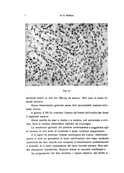 Il cervello Giornale di nevrologia