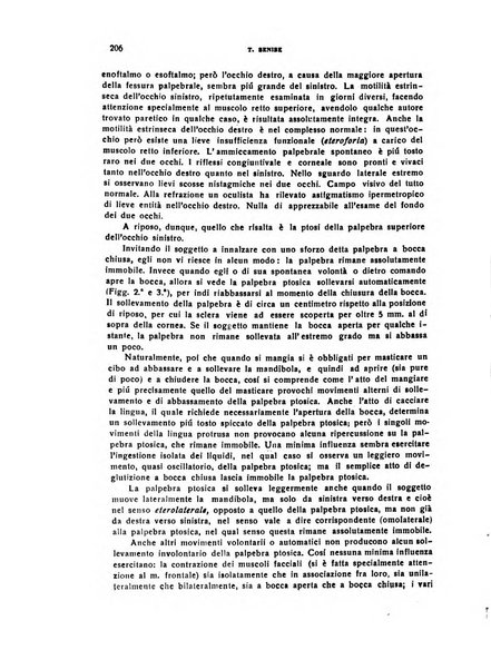 Il cervello Giornale di nevrologia