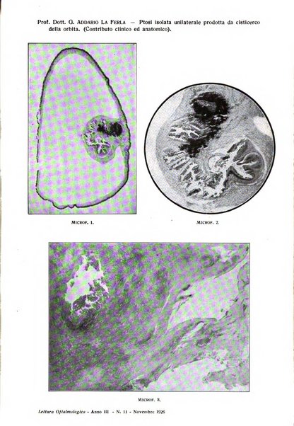 Lettura oftalmologica rivista mensile di oculistica pratica