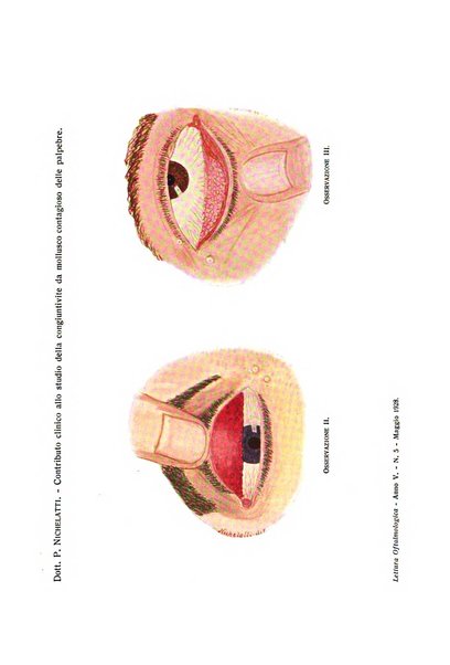 Lettura oftalmologica rivista mensile di oculistica pratica