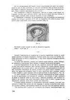 giornale/CFI0351018/1928/unico/00000376