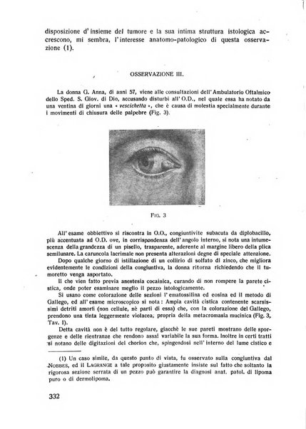 Lettura oftalmologica rivista mensile di oculistica pratica