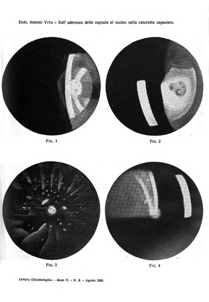 Lettura oftalmologica rivista mensile di oculistica pratica