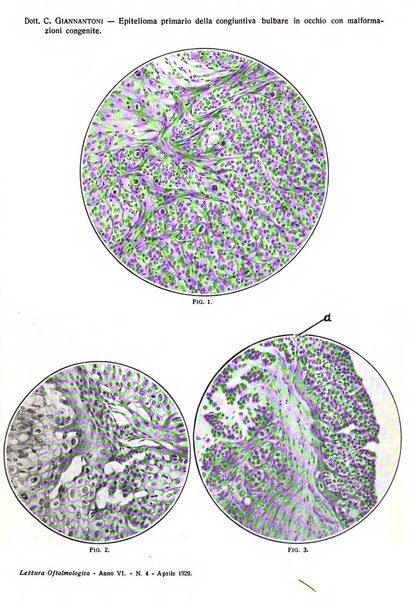 Lettura oftalmologica rivista mensile di oculistica pratica